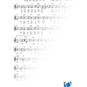 Tey dansa eins og skuggar